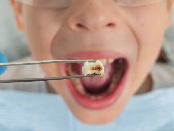 Best Emergency Dental Services for Seniors in Akron, PA